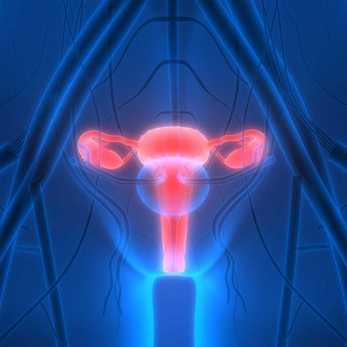 Rak jajnika: co musisz wiedzieć